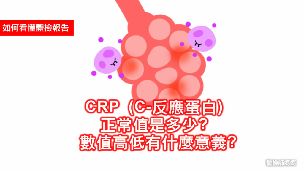 CRP C-反應蛋白